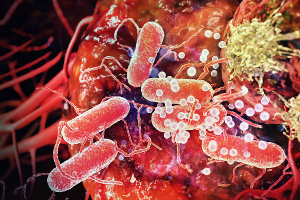 phòng ngừa ung thư phát triển