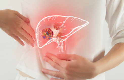 nguoi-benh-viem-gan-nen-an-gi.